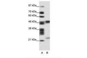 Image no. 1 for anti-PHD Finger Protein 11 (PHF11) (AA 171-220) antibody (ABIN6736092)