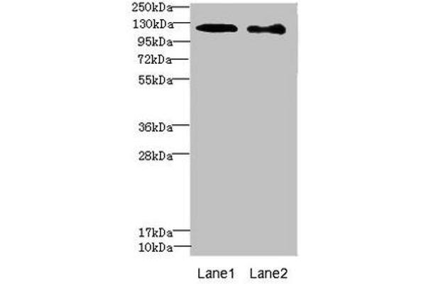 DIAPH2 Antikörper  (AA 1-120)