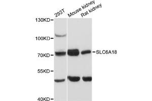 Image no. 1 for anti-Solute Carrier Family 6, Member 18 (SLC6A18) antibody (ABIN6290962)