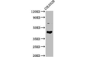 GNAL anticorps  (AA 4-116)