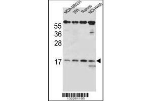 Image no. 1 for anti-T Cell Receptor beta Chain (TCRb) (AA 67-94) antibody (ABIN656127)