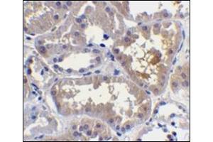 Immunohistochemistry of RAIDD in human kidney tissue with this product at 10 μg/ml.