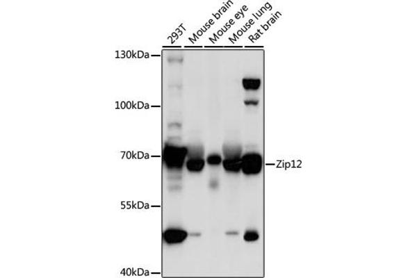 SLC39A12 Antikörper  (AA 1-100)