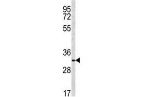 Image no. 1 for anti-NAD(P)H Dehydrogenase, Quinone 1 (NQO1) (AA 118-144) antibody (ABIN3031928)