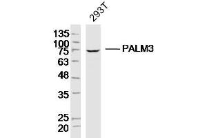 Image no. 1 for anti-Paralemmin 3 (PALM3) (AA 1-100) antibody (ABIN5675704)