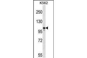Image no. 1 for anti-Janus Kinase 3 (JAK3) (AA 133-161), (N-Term) antibody (ABIN5534437)