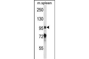 Image no. 2 for anti-PTK2B Protein tyrosine Kinase 2 beta (PTK2B) (AA 672-701) antibody (ABIN5535571)