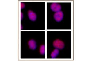 Image no. 3 for anti-CCCTC-Binding Factor (Zinc Finger Protein) (CTCF) (N-Term) antibody (ABIN2668282)