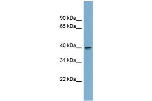 anti-Aspartate beta-Hydroxylase Domain Containing 2 (ASPHD2) (Middle Region) antibody