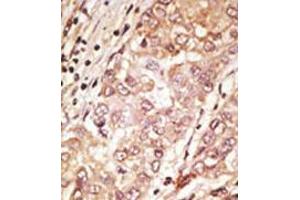 Image no. 2 for anti-Teratocarcinoma-Derived Growth Factor 1 (TDGF1) (N-Term) antibody (ABIN357430)