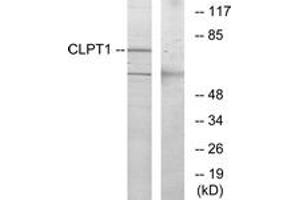 anti-Cleft Lip and Palate Associated Transmembrane Protein 1 (CLPTM1) (AA 200-249) antibody