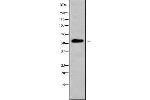 Image no. 1 for anti-Solute Carrier Family 16 (Monocarboxylic Acid Transporters), Member 5 (SLC16A5) (Internal Region) antibody (ABIN6263333)