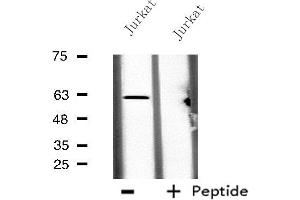Image no. 1 for anti-Carboxylesterase 2 (CES2) (N-Term) antibody (ABIN6258016)