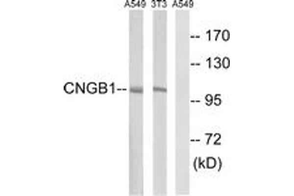 anti-Cyclic Nucleotide Gated Channel beta 1 (CNGB1) (AA 571-620) antibody
