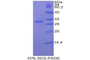 Image no. 1 for DEAD (Asp-Glu-Ala-Asp) Box Polypeptide 58 (DDX58) (AA 550-776) protein (His tag) (ABIN1879727)