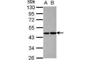 Image no. 1 for anti-Vitamin K-dependent protein C (PROC) (Center) antibody (ABIN2856203)