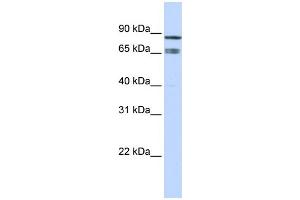 Image no. 4 for anti-IKAROS Family Zinc Finger 1 (Ikaros) (IKZF1) (Middle Region) antibody (ABIN2777317)