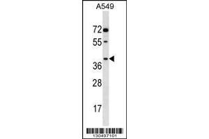 Image no. 1 for anti-Aldo-Keto Reductase Family 1, Member E2 (AKR1E2) (AA 291-320), (C-Term) antibody (ABIN1537068)