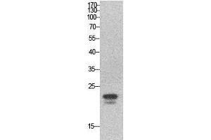 Image no. 2 for anti-Sex Determining Region Y (SRY) (Internal Region) antibody (ABIN3181048)