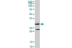 Image no. 1 for anti-Glutathione Transferase zeta 1 (Maleylacetoacetate Isomerase) (GSTZ1) (AA 109-216) antibody (ABIN516249)