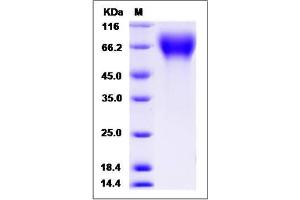 Image no. 1 for CD6 (CD6) (AA 1-396) (Active) protein (His tag) (ABIN2009464)