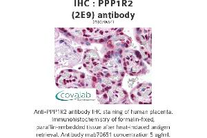 Image no. 2 for anti-Protein Phosphatase 1, Regulatory (Inhibitor) Subunit 2 (PPP1R2) (AA 1-101) antibody (ABIN1723508)