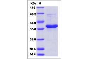 Image no. 1 for Platelet Factor 4 Variant 1 (PF4V1) (AA 1-104) protein (Fc Tag) (ABIN5499808)