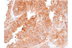 Immunohistochemistry (IHC) image for anti-beta-2-Microglobulin (B2M) antibody (ABIN6940416)