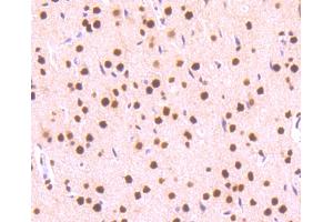 Image no. 7 for anti-Signal Transducer and Activator of Transcription 3 (Acute-Phase Response Factor) (STAT3) (pSer727) antibody (ABIN5557530)