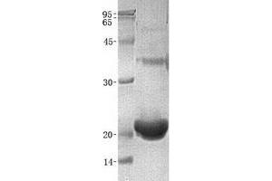 Image no. 1 for Regenerating Islet-Derived 1 alpha (REG1A) protein (ABIN2730684)