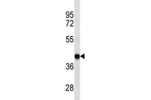 Image no. 1 for anti-Major Histocompatibility Complex, Class I, B (HLA-B) (AA 62-90) antibody (ABIN3031679)