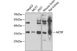 AKTIP Antikörper  (AA 1-292)