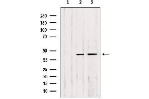anti-Matrix Metallopeptidase 23B (MMP23B) (C-Term) antibody