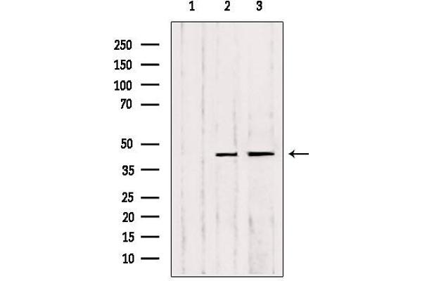 MMP23B Antikörper  (C-Term)