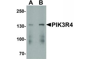 Image no. 1 for anti-Phosphoinositide 3-kinase Regulatory Subunit 4 (PIK3R4) (C-Term) antibody (ABIN6656604)
