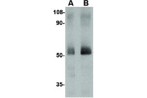 Image no. 1 for anti-Sprouty-Related, EVH1 Domain Containing 2 (SPRED2) (Internal Region) antibody (ABIN6655374)