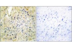 Image no. 1 for anti-Deleted in Lung and Esophageal Cancer 1 (DLEC1) (AA 1-50) antibody (ABIN1534201)
