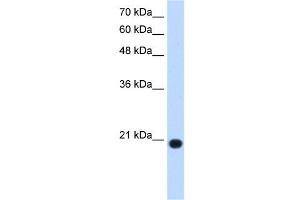 Image no. 1 for anti-Ubiquitously-Expressed, Prefoldin-Like Chaperone (UXT) (N-Term) antibody (ABIN629698)