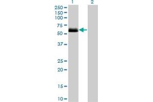 Image no. 1 for anti-Casein Kinase 1, gamma 2 (CSNK1G2) (AA 315-415) antibody (ABIN514704)