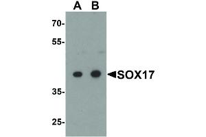 Image no. 2 for anti-SRY (Sex Determining Region Y)-Box 17 (SOX17) (Internal Region) antibody (ABIN6656854)
