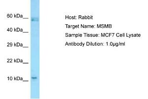 Image no. 1 for anti-Microseminoprotein, beta (MSMB) (C-Term) antibody (ABIN2789767)