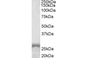 Image no. 1 for anti-Paired-Like Homeobox 2a (PHOX2A) (AA 165-179) antibody (ABIN5539795)