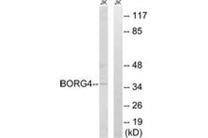 Image no. 1 for anti-CDC42 Effector Protein (Rho GTPase Binding) 4 (CDC42EP4) (AA 201-250) antibody (ABIN1534742)