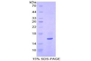 Image no. 1 for Quiescin Q6 Sulfhydryl Oxidase 1 (QSOX1) (AA 394-519) protein (His tag) (ABIN1879423)