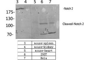 Image no. 3 for anti-Notch 2 (NOTCH2) (Asp1733), (cleaved) antibody (ABIN3181821)