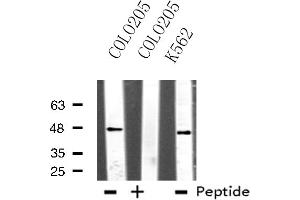 Image no. 1 for anti-TEA Domain Family Member 1 (SV40 Transcriptional Enhancer Factor) (TEAD1) antibody (ABIN6257778)