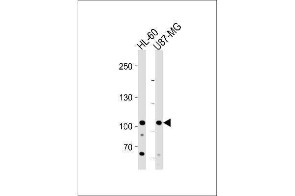 anti-MORC Family CW-Type Zinc Finger 3 (MORC3) (AA 634-663) antibody