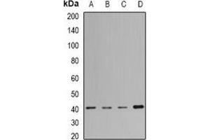 Image no. 3 for anti-H2A Histone Family, Member Y (H2AFY) antibody (ABIN2966788)