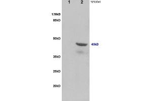 Image no. 4 for anti-Tumor Susceptibility Gene 101 (TSG101) (AA 4-120) antibody (ABIN685507)