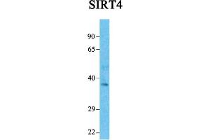 Image no. 3 for anti-Sirtuin 4 (SIRT4) (Middle Region) antibody (ABIN2779654)